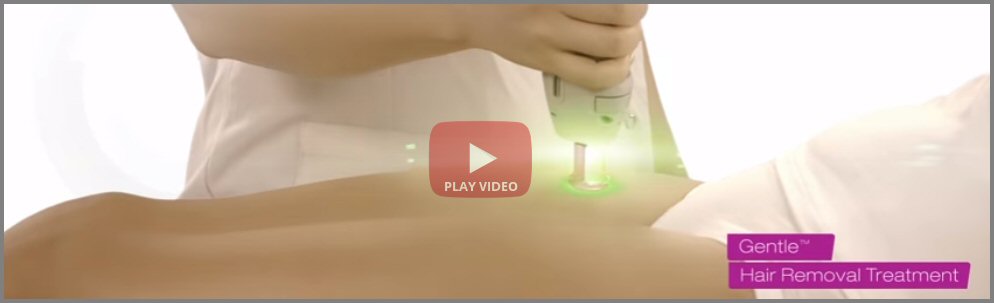 Laser Hair Removal Video